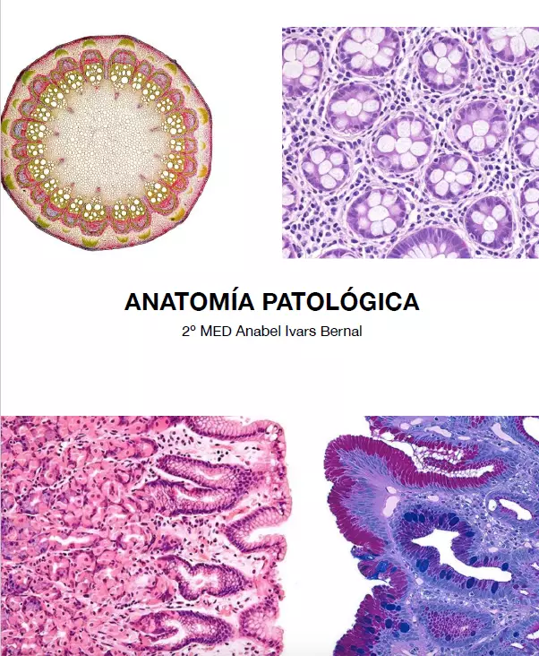 Anatomía patológica